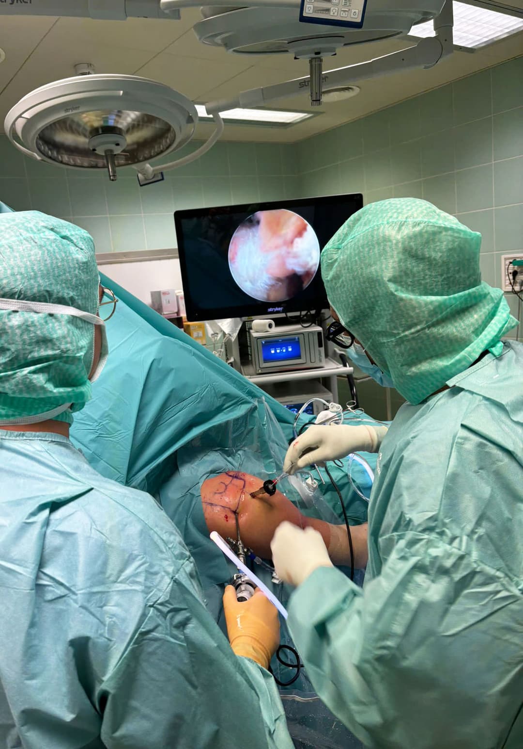 Intervento al ginocchio